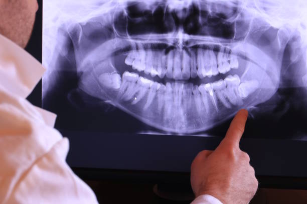 Best Emergency Dental Care for Broken or Chipped Teeth in Midway, GA