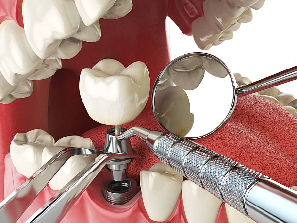 Best Emergency Dental Care for Broken or Chipped Teeth in Midway, GA